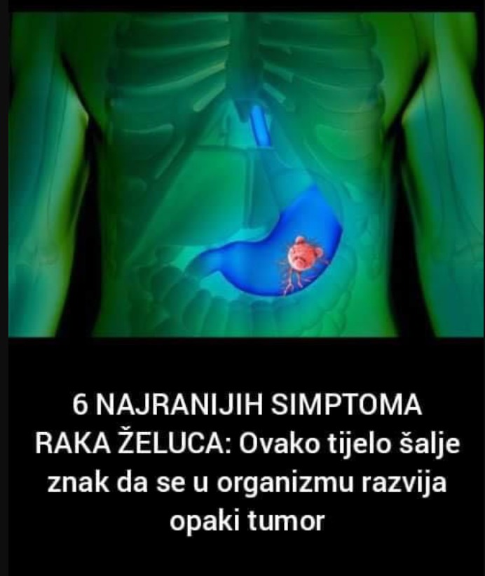 6 NAJRANIJIH SIMPTOMA RAKA ŽELUCA: Ovako tijelo šalje znak da se u organizmu razvija opaki tumor!
