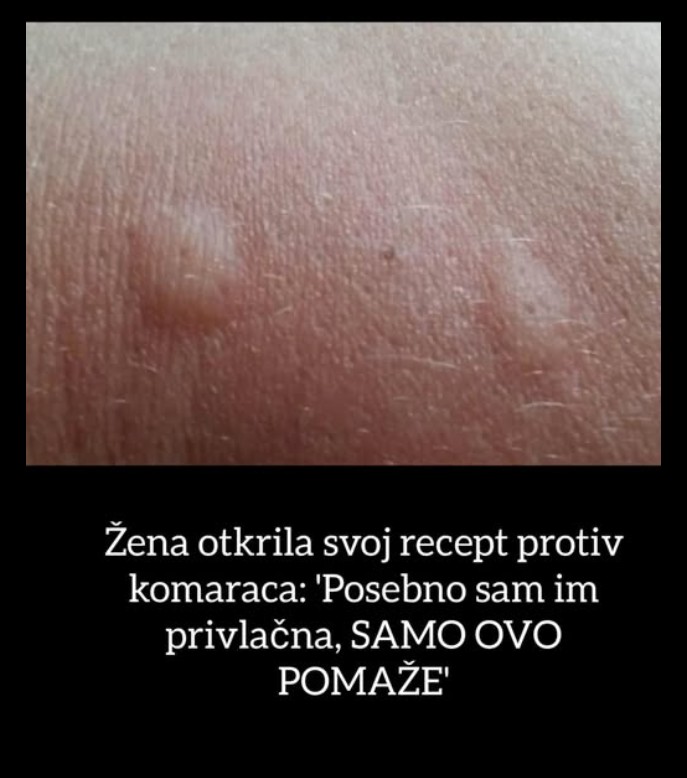 Žena iz Amerike otkriva prirodni repelent protiv komaraca