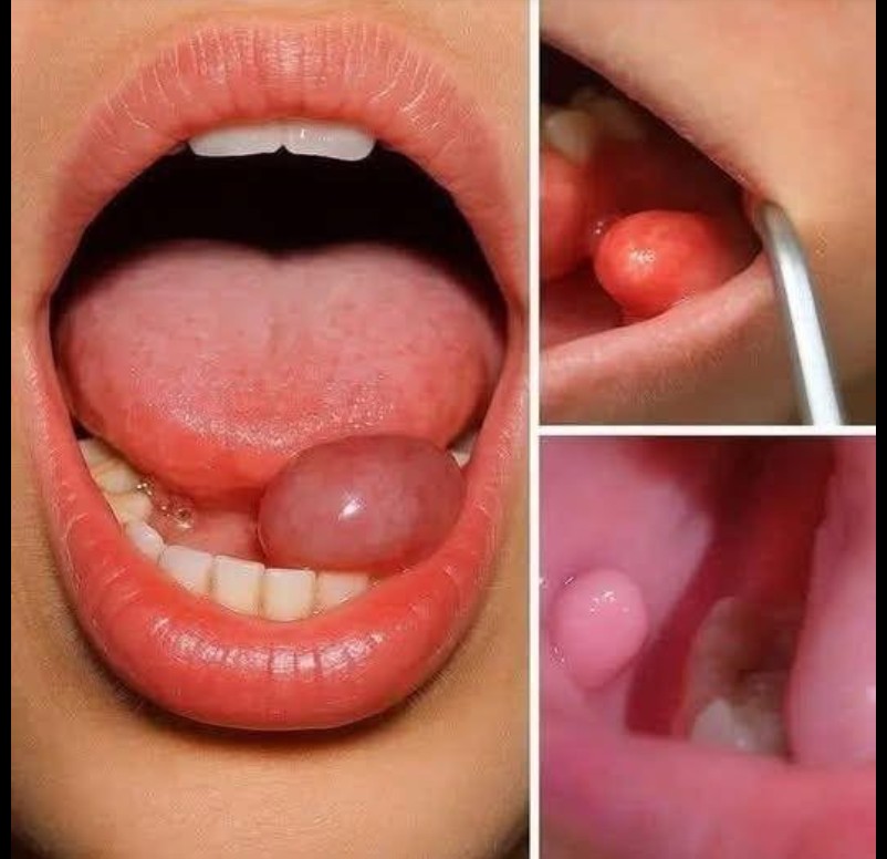 Oralno zdravlje: Važnost ranog prepoznavanja promena u usnoj duplji
