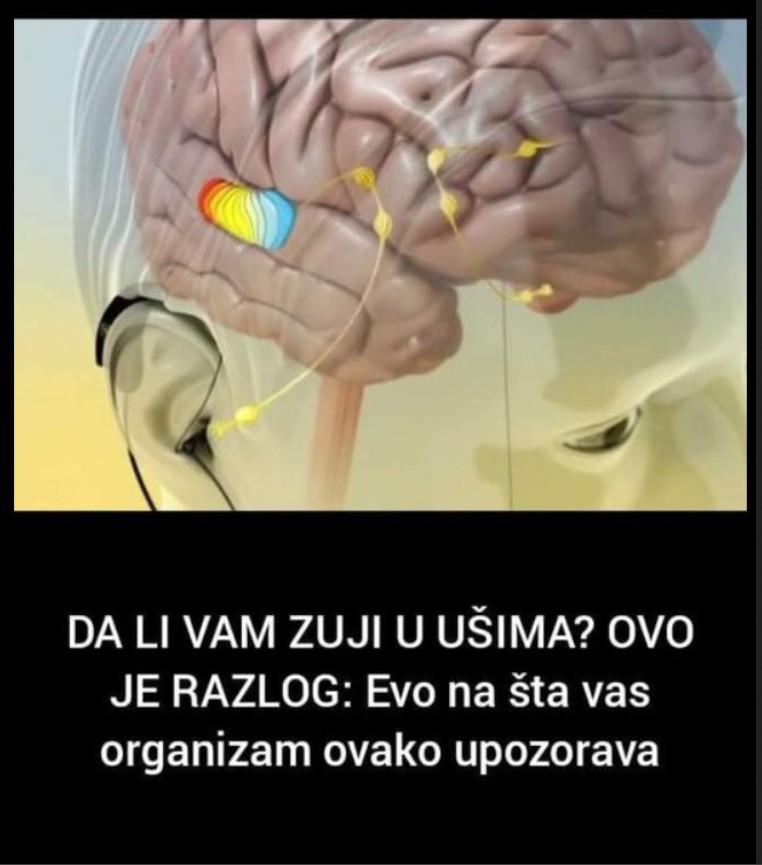 Šta je tinitus i zašto dolazi do zujanja u ušima?