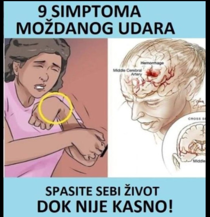 9 SIMPTOMA KOJI UPOZORAVAJU NA MOŽDANI UDAR: Čim osjetite OVO TRČITE DOKTORU – NE ČEKAJTE DA BUDE KASNO