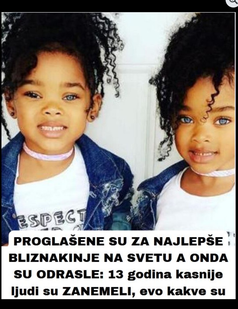Megan i Morgan: Priča o sestrama koje su osvojile svijet svojim jedinstvenim izgledom