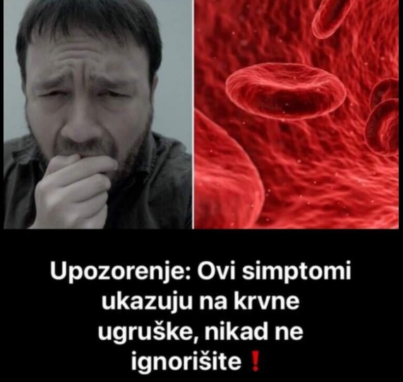 Znate li kako prepoznati KRVNE UGRUŠKE? Ove simptome shvatite JAKO OZBILJNO !