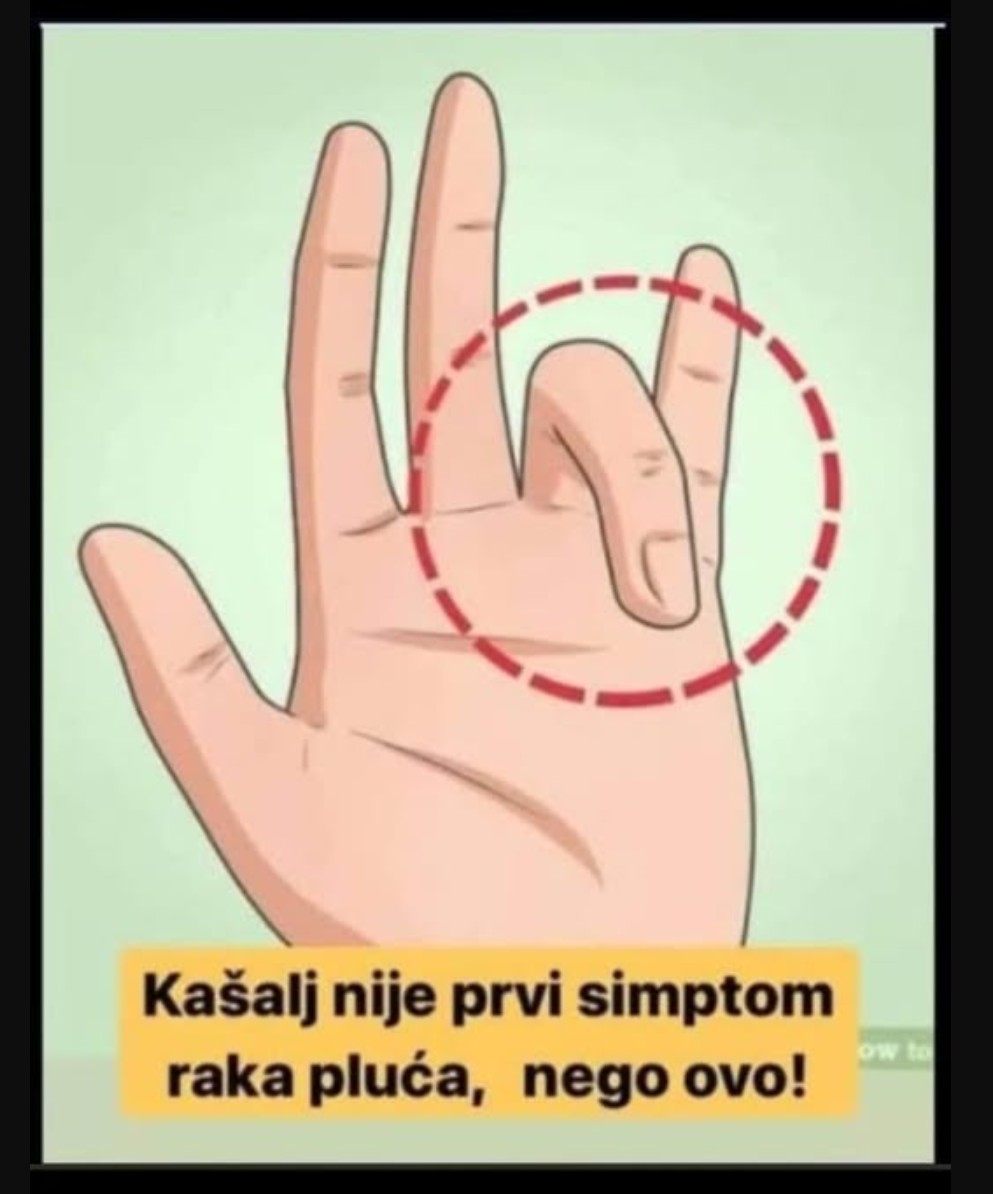 KAŠALJ NIJE PRVI SIMPTOM RAKA, NEGO OVO: Ako ih uočite, treba odmah da se javite doktoru!