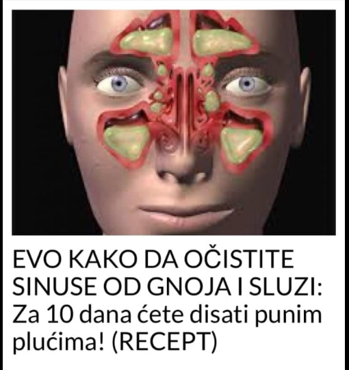 EVO KAKO DA OČISTITE SINUSE OD GNOJA I SLUZI: Za 10 dana ćete disati punim plućima! (RECEPT)