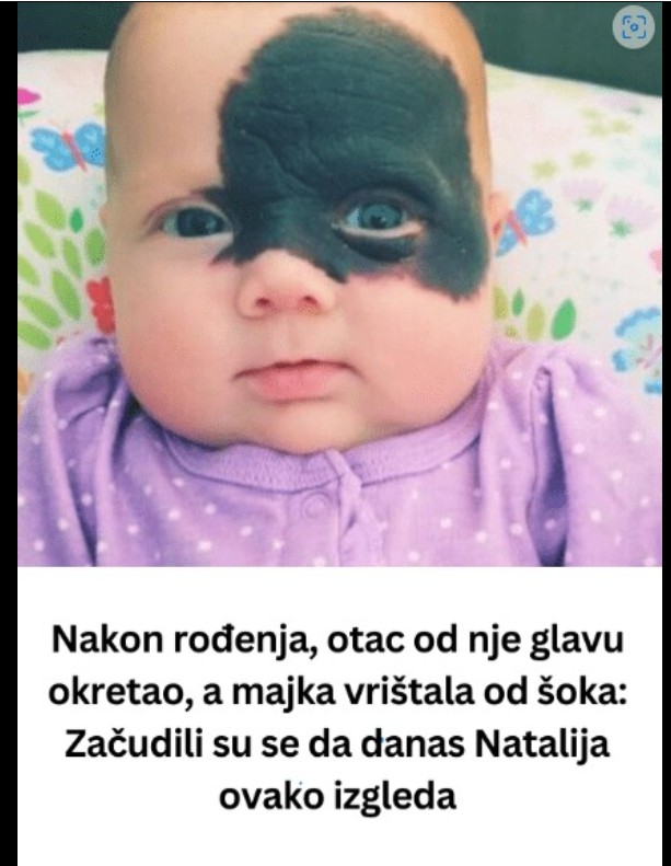 Priča o Natali: Snaga različitosti i ljepota prihvatanja