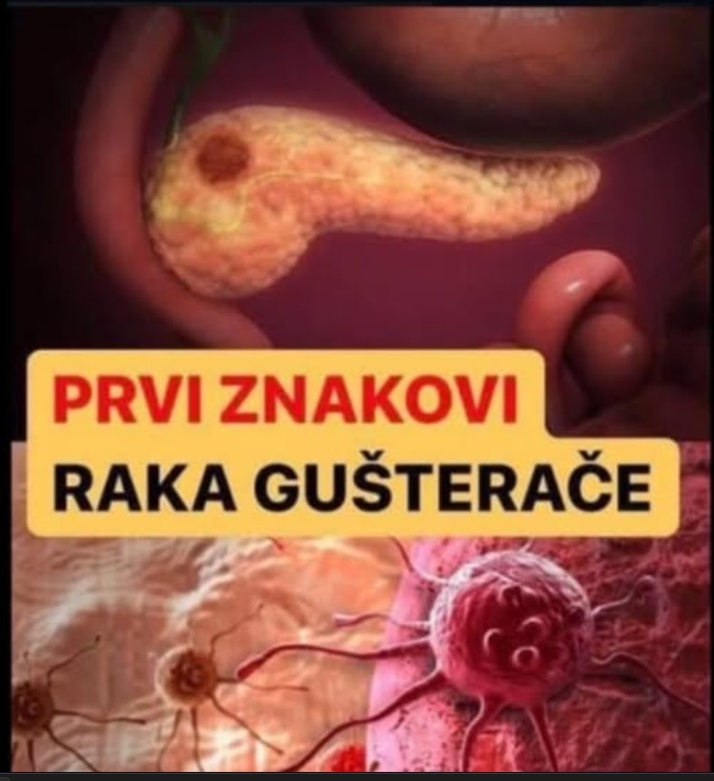 KARCINOM GUŠTERAČE: Ovo je 8 simptoma koje ne smijete ignorisati, ako ih primijetite HITNO KOD DOKTORA DOK NIJE KASNO!