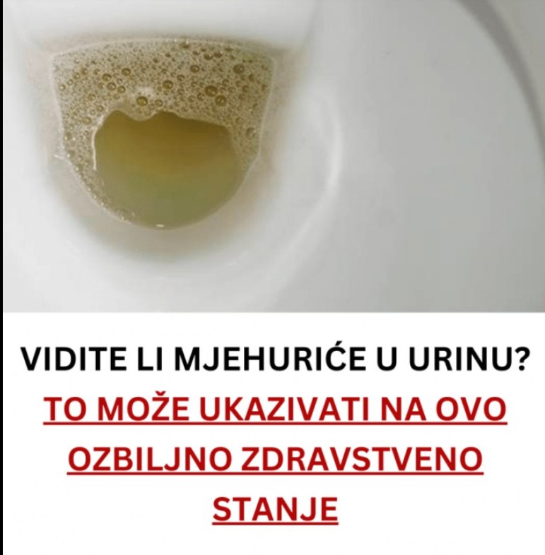 Šta znače mjehurići u mokraći i kada ih ne treba ignorirati