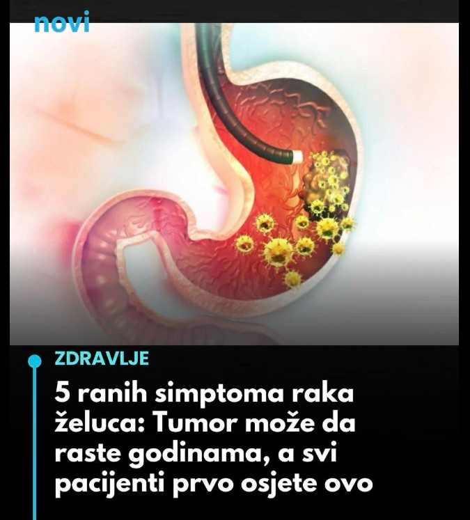 5 ranih simptoma raka želuca koje ne smijete ignorisati