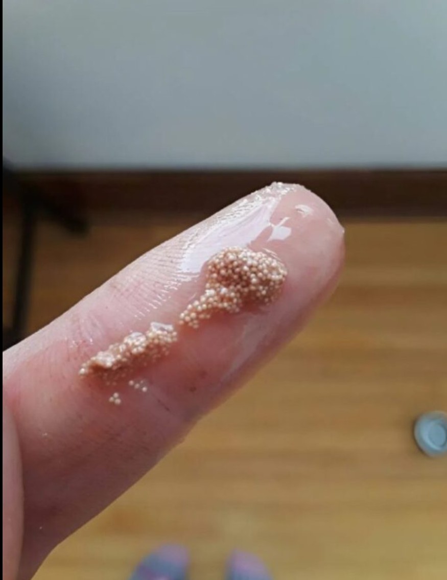 Bele grudvice u jajetu: šta zapravo znače i kako da znate da li je jaje sveže