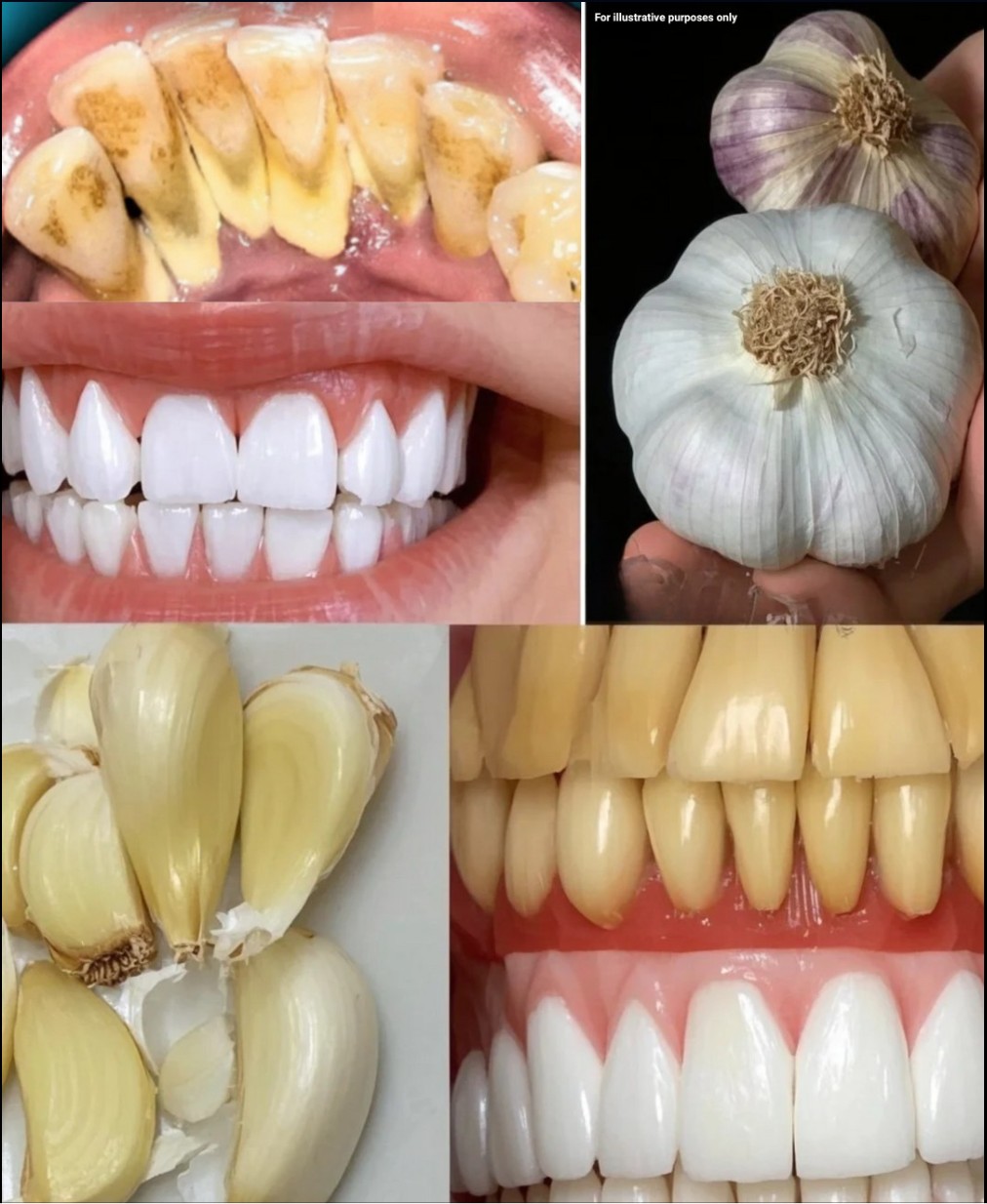 🧄 Beli luk i zdravlje zuba: Prirodni saveznik za jači osmeh