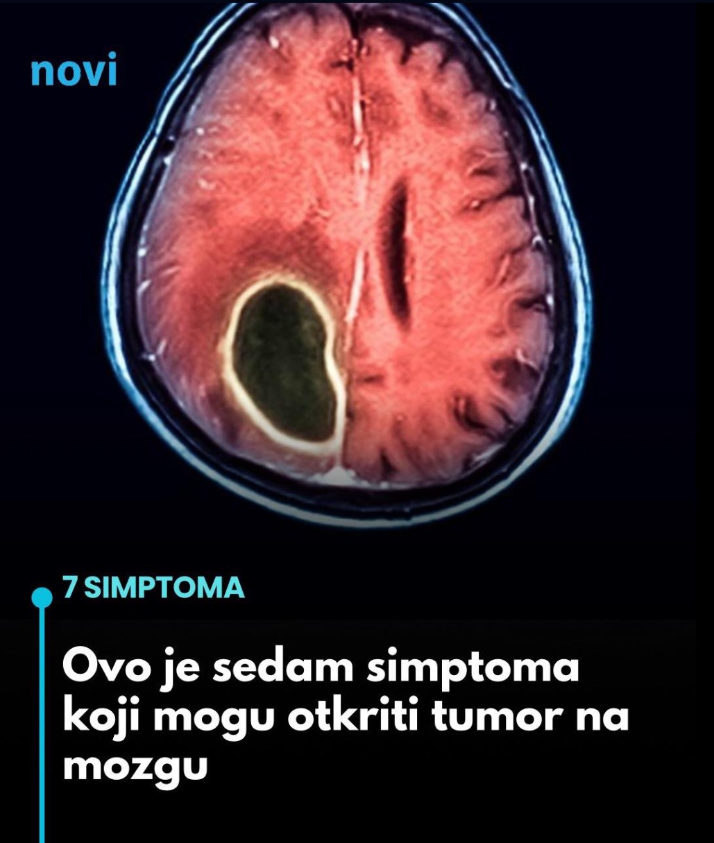 Sedam ranih simptoma koji mogu ukazivati na tumor na mozgu – šta nikako ne treba ignorisati