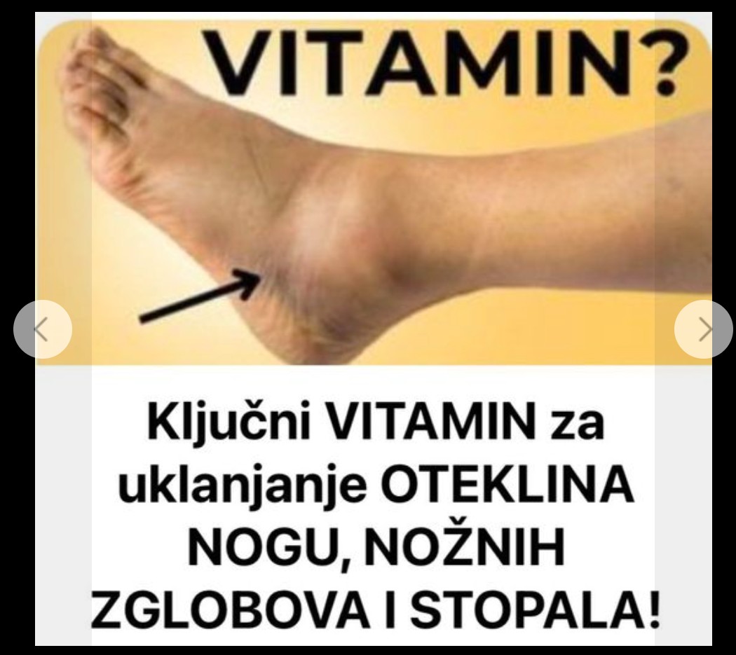 Bitni vitamini protiv oticanja nogu,zglobova i članaka