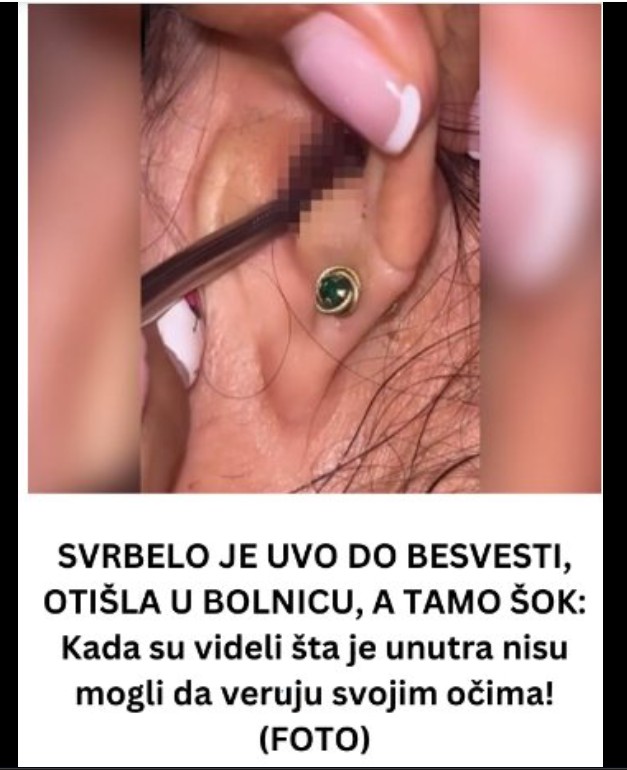 Nepodnošljiv svrab u uhu pretvorio se u ozbiljan problem: Šta možemo naučiti iz ovog neobičnog slučaja