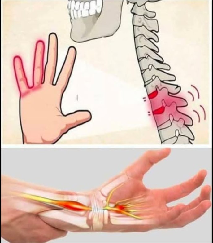 Zašto se ruke i noge ponekad utrnu?