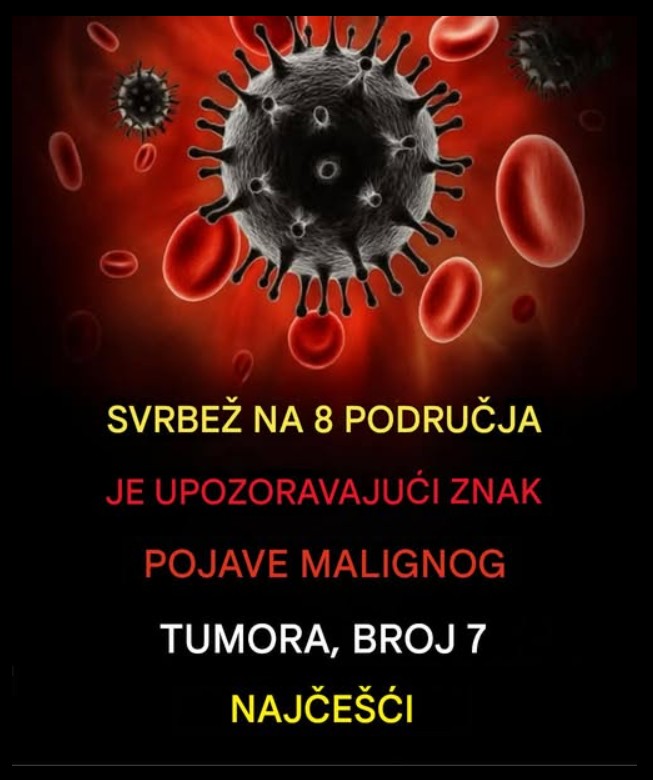 Svrab kože kao signal tijela: kada je bezazlen, a kada zahtijeva pažnju