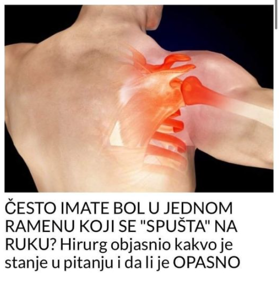 ČESTO IMATE BOL U JEDNOM RAMENU KOJI SE “SPUŠTA” NA RUKU? Hirurg objasnio kakvo je stanje u pitanju i da li je OPASNO