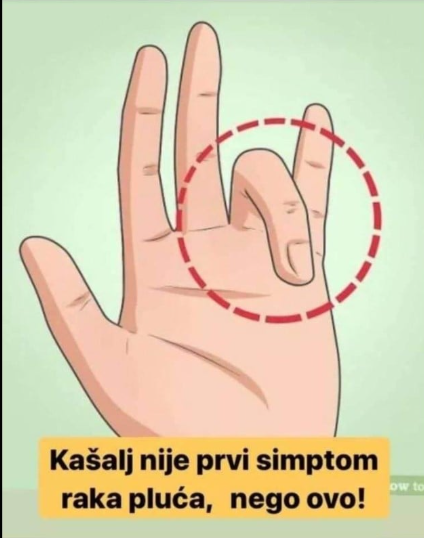 KAŠALJ NIJE PRVI SIMPTOM RAKA, NEGO OVO: Ako ih uočite, treba odmah da se javite doktoru!