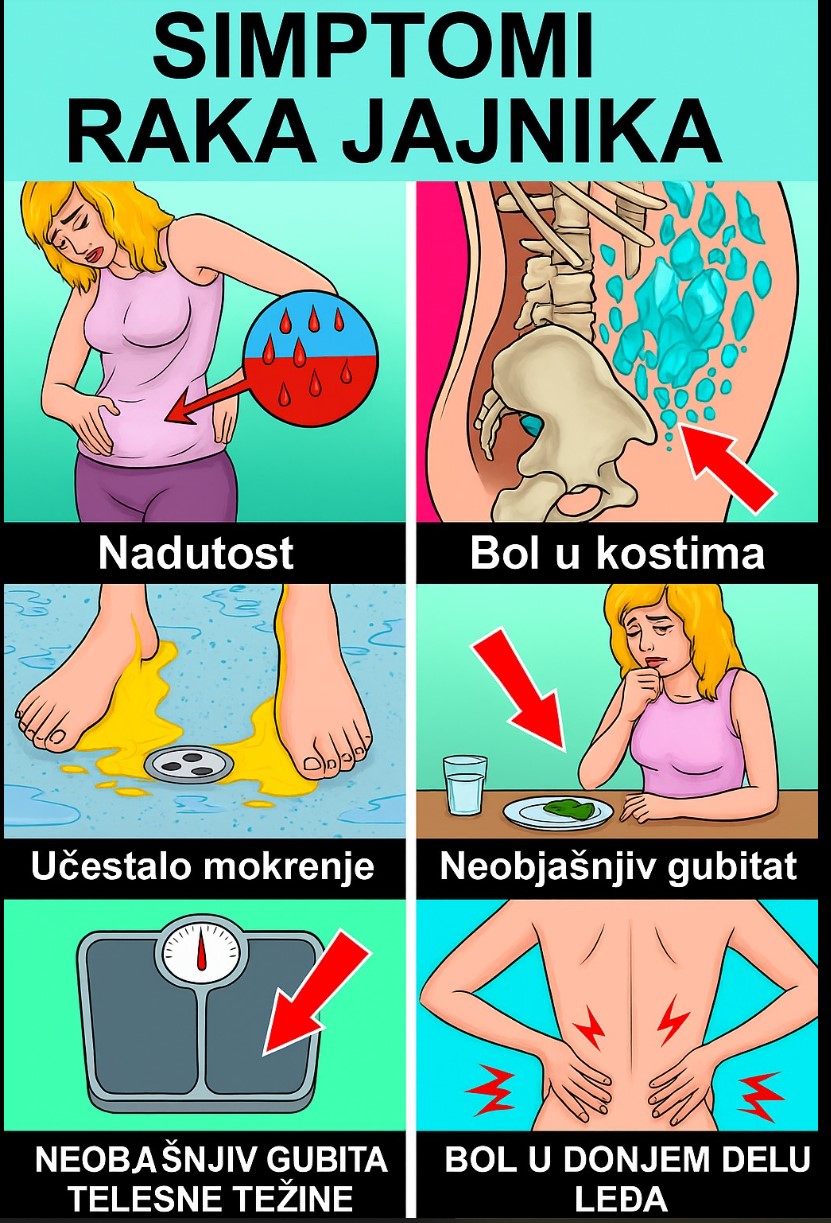 Povezanost raka dojke i raka jajnika: Šta svaka žena treba da zna