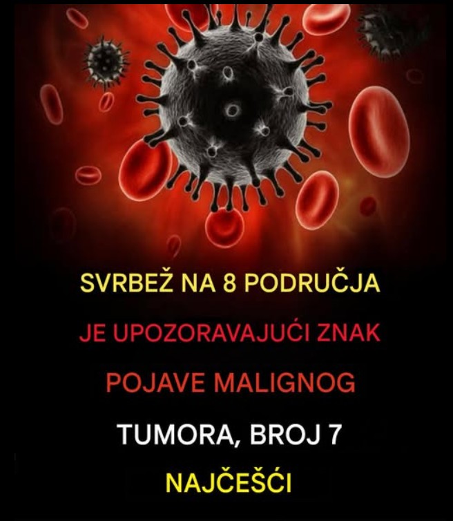 „Šta uzrokuje svrab na različitim dijelovima tijela: kada je bezopasan, a kada potražiti savjet ljekara“