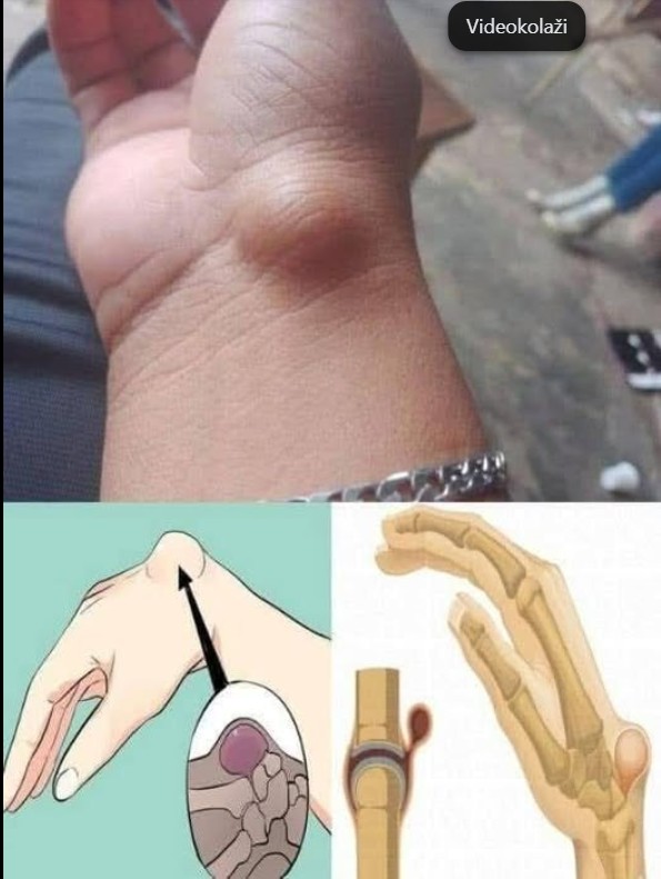 Modrice na koži: Mogući uzroci i kada se obratiti ljekaru