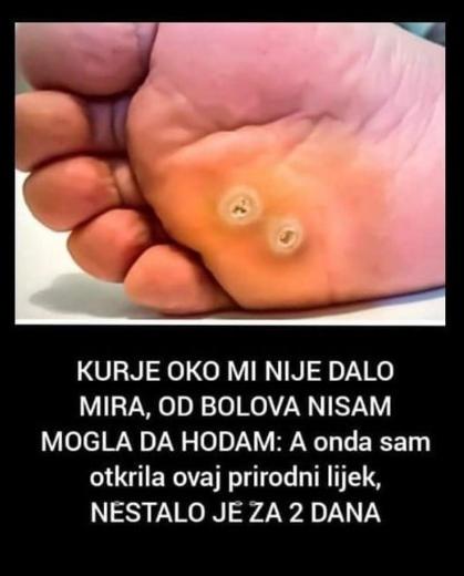 KURJE OKO MI NIJE DALO MIRA, OD BOLOVA NISAM MOGLA DA HODAM: A onda sam otkrila ovaj prirodni lijek, NESTALO JE ZA 2 DANA