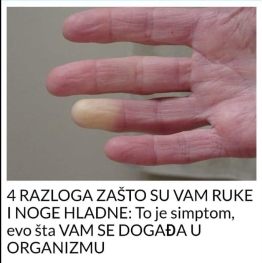 4 RAZLOGA ZAŠTO SU VAM RUKE I NOGE HLADNE: To je simptom, evo šta VAM SE DOGAĐA U ORGANIZMU