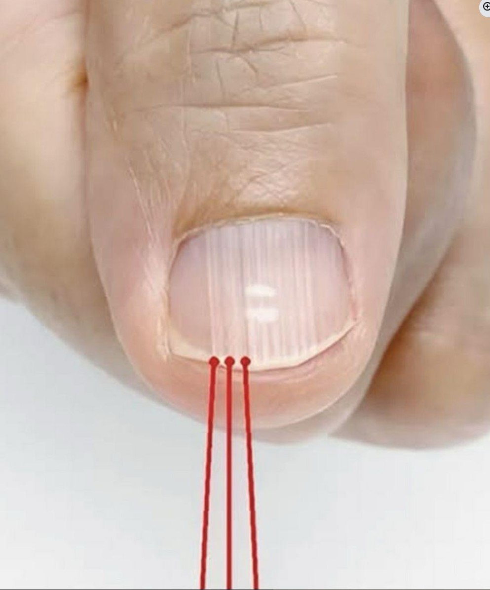 Nokti kao indikator zdravlja: Što promjene na noktima mogu značiti za vaše zdravlje