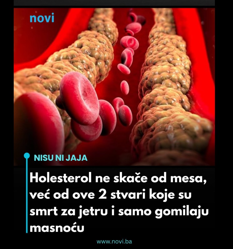 Holesterol i masna jetra: Zašto problem često ne dolazi od mesa, već od dvije druge navike
