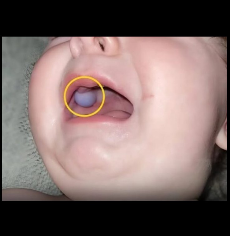 Neobičan simptom kod bebe važna lekcija za sve roditelje