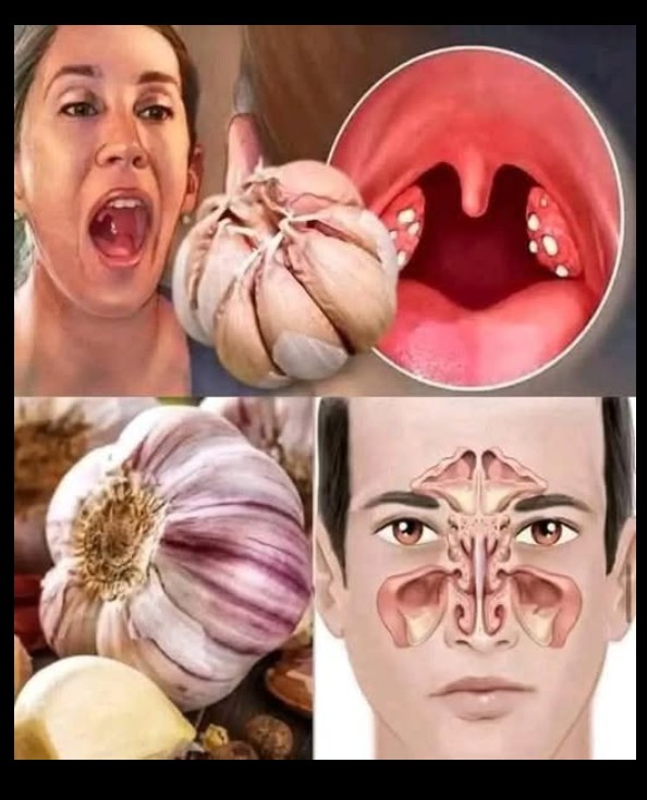 Šta svakodnevna konzumacija belog luka zaista radi vašem telu: Detaljan vodič kroz najvažnije zdravstvene efekte