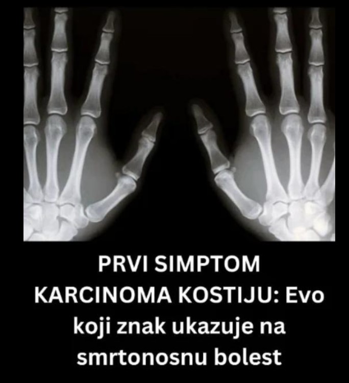 Bol u kostima kao upozorenje: kada je važno reagovati na vrijeme