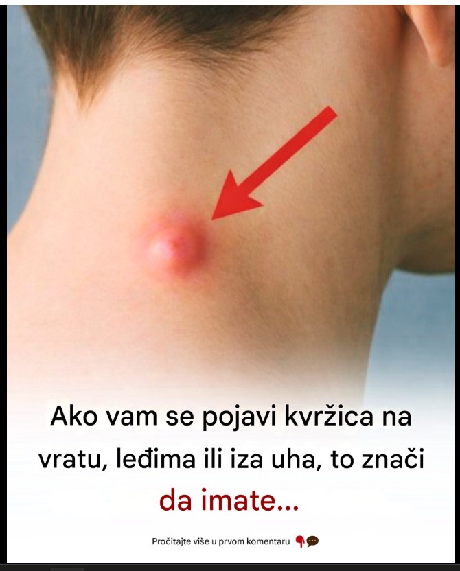 Kvržice na vratu, leđima ili iza uha: šta mogu značiti i kako pravilno reagovati