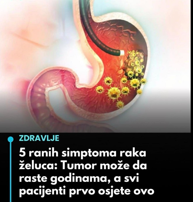 5 ranih simptoma raka želuca koje ne smijete ignorisati