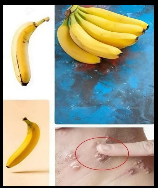 „Banane u svakodnevnoj ishrani: nutritivne vrednosti i dobrobiti umerene konzumacije“