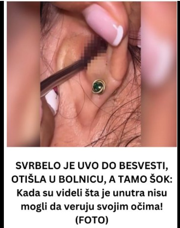 Nepodnošljiv svrab u uhu pretvorio se u ozbiljan problem: Šta možemo naučiti iz ovog neobičnog slučaja