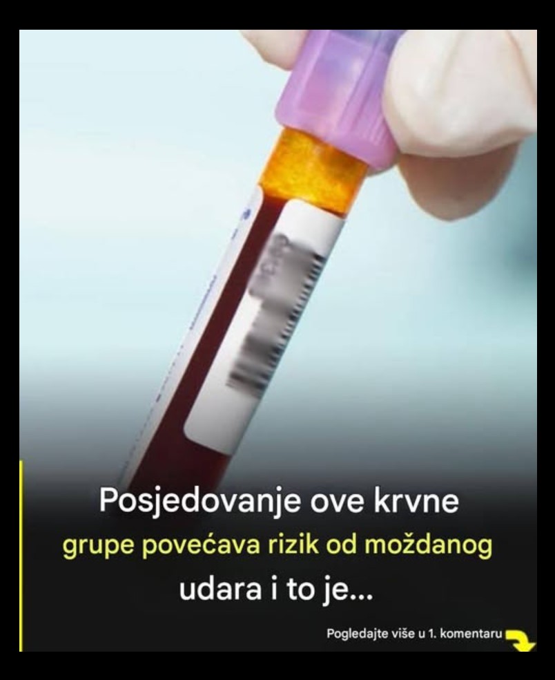 Da li krvna grupa može utjecati na rizik od moždanog udara?
