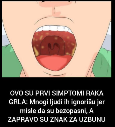 OVO SU PRVI SIMPTOMI RAKA GRLA: Mnogi ljudi ih ignorišu jer misle da su bezopasni, A ZAPRAVO SU ZNAK ZA UZBUNU
