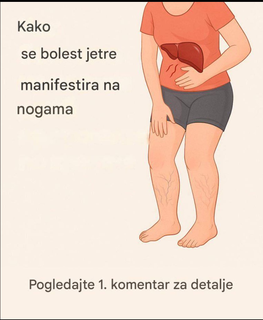 Znakovi koje ne treba ignorisati: kako se promjene na nogama mogu ukazivati ​​na probleme sa jetrom