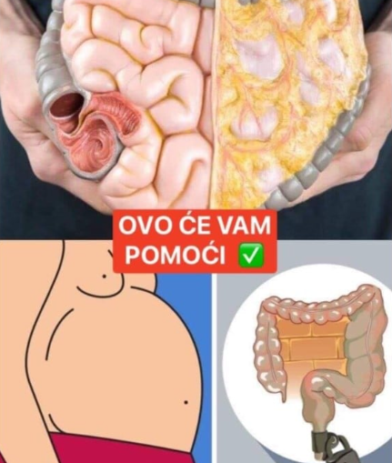 ŽELUDAC VAM NE VARI HRANU I STOMAK VAM JE NAPUHAN?: Odmah otiđite u kuhinju i OVO NAPRAVITE – preporodit ćete se!