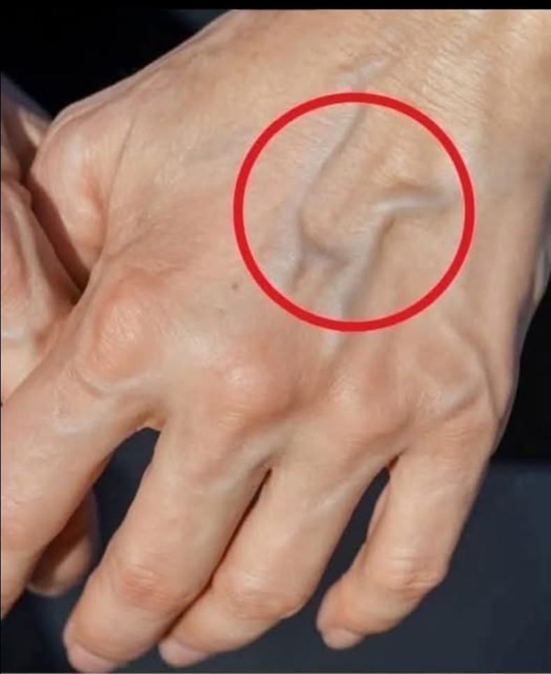 Bol u venama na rukama: mogući uzroci, simptomi i kada tražiti stručni savjet