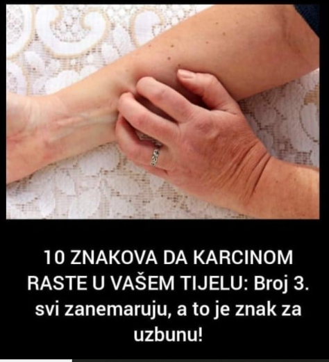 10 ZNAKOVA DA KARCINOM RASTE U VAŠEM TIJELU: Broj 3. svi zanemaruju, a to je znak za uzbunu!