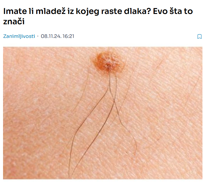 Imate li mladež iz kojeg raste dlaka? Evo šta to znači