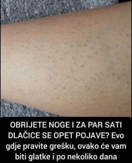 OBRIJETE NOGE I ZA PAR SATI DLAČICE SE OPET POJAVE? Evo gdje pravite grešku, ovako će vam biti glatke i po nekoliko dana