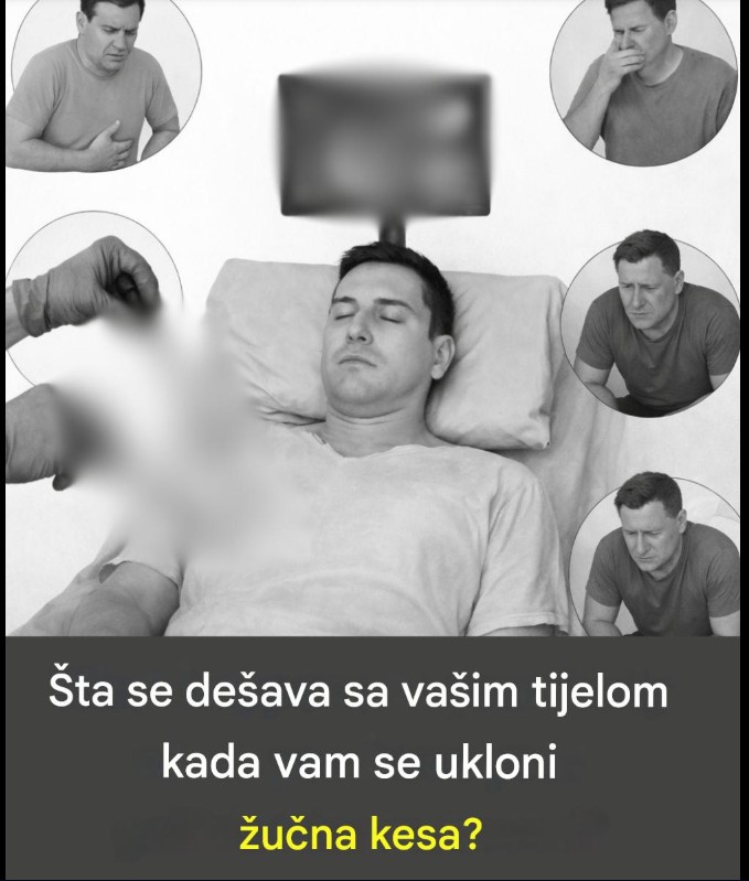 Život bez žučne kese: Kako se telo menja nakon operacije i kako olakšati varenje