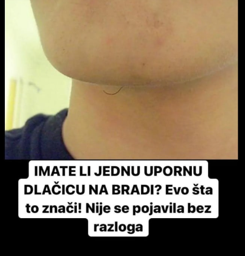 IMATE LI JEDNU UPORNU DLAČICU NA BRADI? Evo šta to znači! Nije se pojavila bez razloga