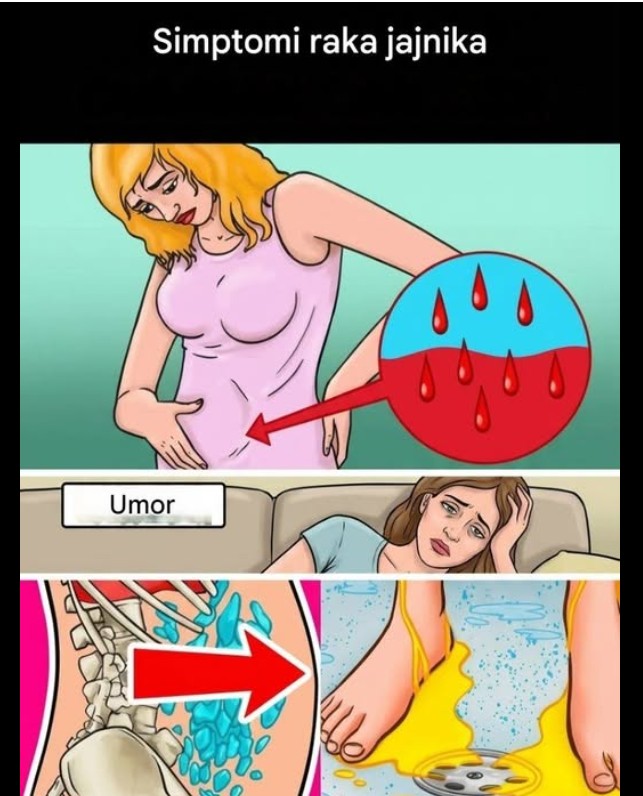 Kakva je veza između raka dojke i raka jajnika i zašto je važno da je poznajete