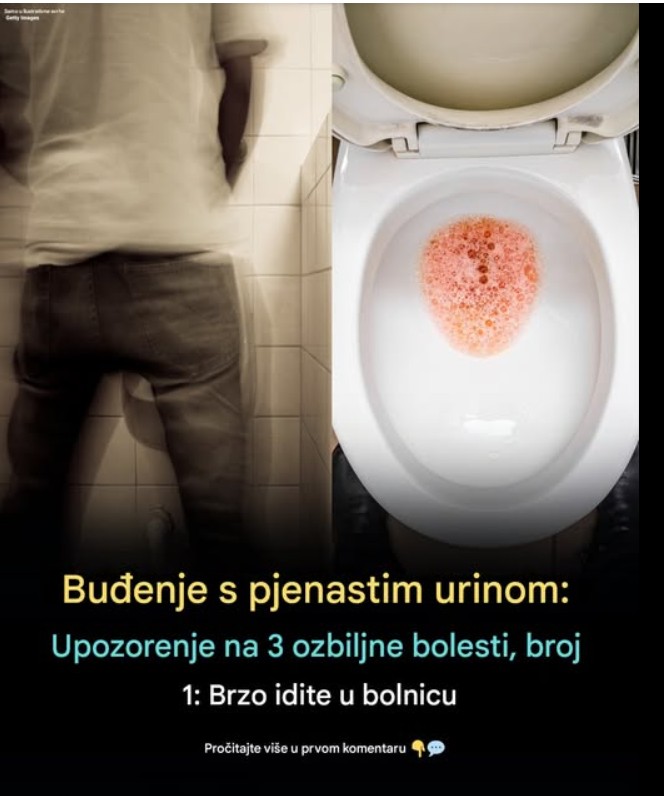 Penušav urin: kada je bezazlen, a kada znak da treba posetiti lekara