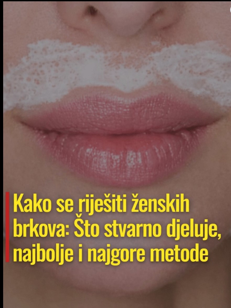 Kako se riješiti dlačica iznad gornje usneProvjerene metode, šta zaista djeluje i šta je bolje izbjeći