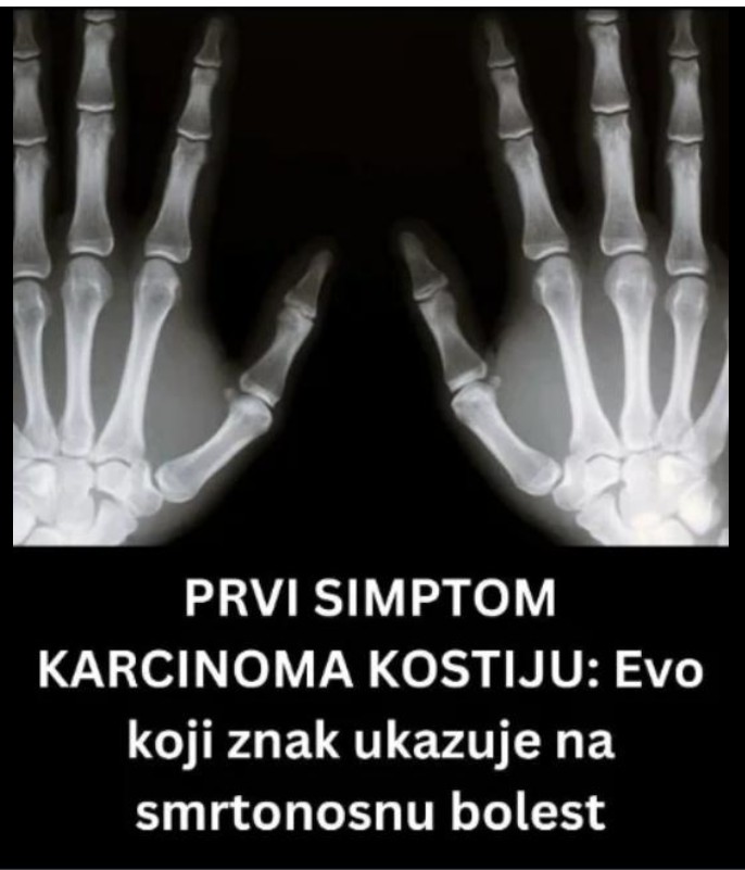 Bol u kostima kao upozorenje: kada je važno reagovati na vrijeme